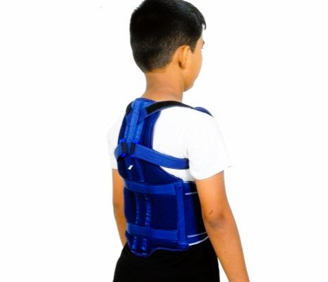 Child Customised Spinal Brace - Image 3