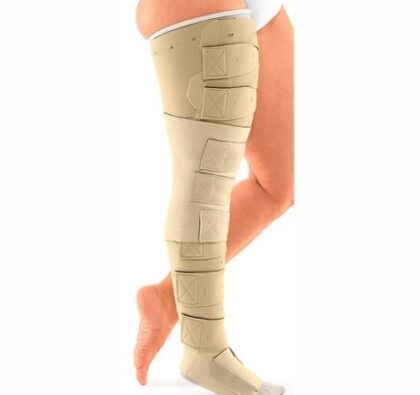 Lymphedema Straps (Thigh Level)
